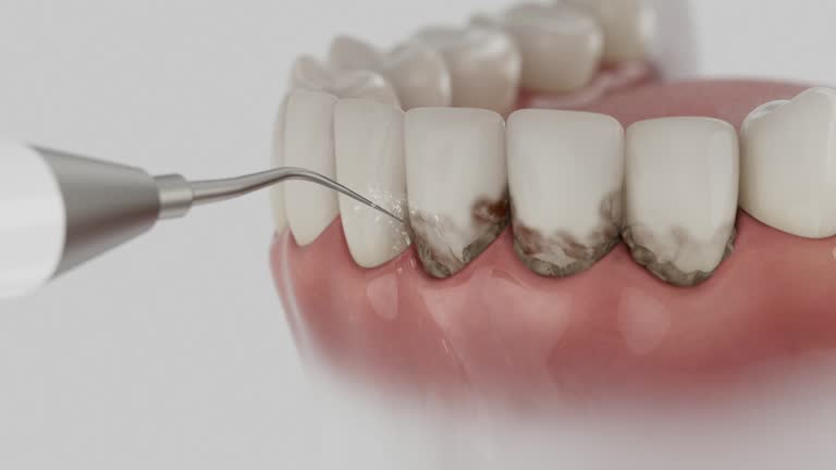 Trusted Dental Crowns And Bridges service in Trevose, PA - Dentist Open Now